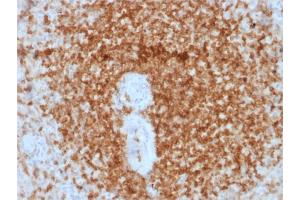 Formalin-fixed, paraffin-embedded human Spleen stained with Bcl-2 Mouse Recombinant Monoclonal Antibody (rBCL2/796).