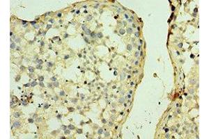 Immunohistochemistry of paraffin-embedded human testis tissue using ABIN7170478 at dilution of 1:100 (SPAG5 Antikörper  (AA 1-300))