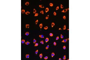 Immunofluorescence analysis of L929 cells using KIF21A Rabbit pAb (ABIN7268127) at dilution of 1:100. (KIF21A Antikörper  (AA 1070-1270))