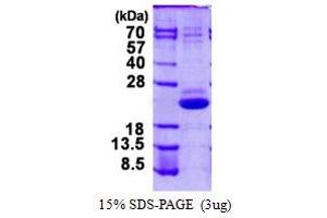 Image no. 1 for Vacuolar Protein-Sorting-Associated Protein 25 (VPS25) protein (His tag) (ABIN1098226) (VPS25 Protein (His tag))
