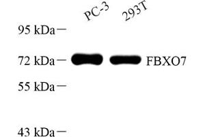 Western blot analysis of FBXO7 (ABIN7073906) at dilution of 1: 500