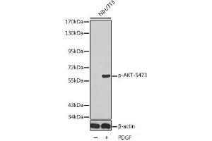 Western blot analysis of extracts from NIH/3T3 using Phospho-AKT(S473) Polyclonal Antibody. (AKT1 Antikörper  (pSer473))