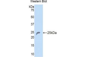 Western blot analysis of the recombinant protein. (COL6A1 Antikörper  (AA 816-1002))