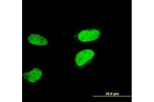 Image no. 1 for anti-Activating Transcription Factor 2 (ATF2) (AA 1-210) antibody (ABIN598626) (ATF2 Antikörper  (AA 1-210))