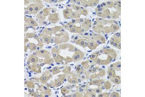 Immunohistochemistry of paraffin-embedded human stomach using HSD11B2 antibody (ABIN5995471) at dilution of 1/100 (40x lens). (HSD11B2 Antikörper)