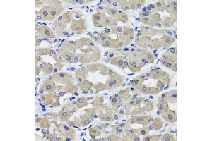 Immunohistochemistry of paraffin-embedded human stomach using HSD11B2 antibody (ABIN5995471) at dilution of 1/100 (40x lens).