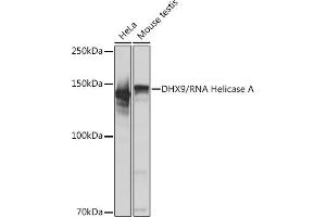 Western blot analysis of extracts of various cell lines, using DHX9/DHX9/RNA Helicase A Rabbit mAb (ABIN7265747) at 1:1000 dilution. (DHX9 Antikörper)