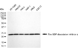 Western blotting analysis using Rho GDP dissociation inhibitor alpha antibody (ABIN7800194).