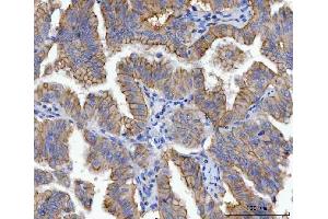 IHC analysis of gamma Catenin using anti-gamma Catenin antibody (ABIN7602031).