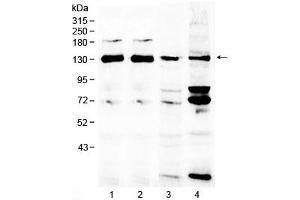Western blot testing of 1) rat brain, 2) mouse brain, 3) human MCF7 and 4) human 293T lysate with NCKAP1 antibody at 0. (NCKAP1 Antikörper)