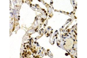 Immunohistochemistry of paraffin-embedded Human lung using TFDP1 Polyclonal Antibody at dilution of 1:200 (40x lens). (DP1 Antikörper)