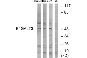 Western blot analysis of extracts from HepG2 cells, HeLa cells and Jurkat cells, using B4GALT3 antibody. (B4GALT3 Antikörper  (Internal Region))