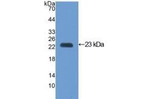 Detection of Recombinant VCAM1, Mouse using Polyclonal Antibody to Vascular Cell Adhesion Molecule 1 (VCAM1) (VCAM1 Antikörper  (AA 116-309))