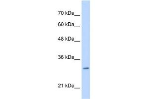 WB Suggested Anti-MLF2 Antibody Titration:  0. (MLF2 Antikörper  (C-Term))