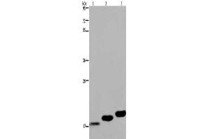 Gel: 8 % SDS-PAGE, Lysate: 40 μg, Lane 1-3: Mouse skeletal muscle, Mouse heart tissue, Mouse bladder tissue, Primary antibody: ABIN7130317(MYL12B Antibody) at dilution 1/450, Secondary antibody: Goat anti rabbit IgG at 1/8000 dilution, Exposure time: 20 seconds