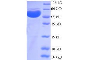 PRMT1 Protein (AA 1-248, partial) (GST tag)