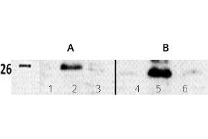 Image no. 3 for anti-Twist Homolog 1 (Drosophila) (TWIST1) (N-Term) antibody (ABIN347415) (TWIST1 Antikörper  (N-Term))