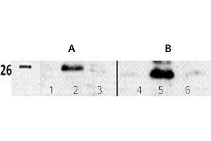 Image no. 3 for anti-Twist Homolog 1 (Drosophila) (TWIST1) (N-Term) antibody (ABIN347415)