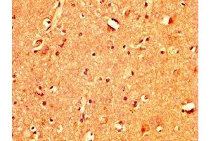 IHC image of ABIN7171314 diluted at 1:400 and staining in paraffin-embedded human brain tissue performed on a Leica BondTM system. (TBX3 Antikörper  (AA 297-479))