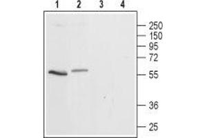 Western blot analysis of rat (lanes 1 and 3) and mouse (lanes 2 and 4) brain lysates: - 1,2. (Serotonin Receptor 3A Antikörper  (2nd Cytoplasmic Loop))