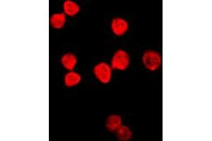 Immunofluorescent analysis of Thymine DNA Glycosylase staining in HeLa cells.