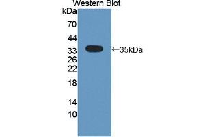 Western blot analysis of the recombinant protein. (CRLF1 Antikörper  (AA 110-408))