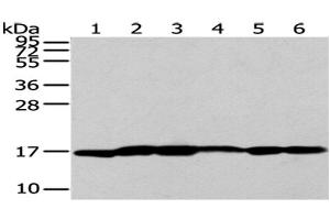 Western Blot analysis of A431 cells and Human liver cancer tissue, Lovo and PC3 cells, Human placenta tissue and 293T cells using UTS2B Polyclonal Antibody at dilution of 1/200 (Urotensin 2B Antikörper)