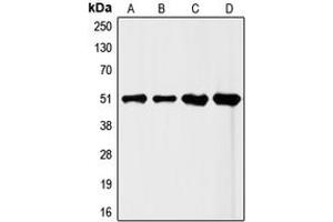 Western blot analysis of FLI1 expression in HeLa (A), Jurkat (B), mouse liver (C), rat liver (D) whole cell lysates.