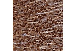 Immunohistochemical staining of human stomach with TMEM196 polyclonal antibody  shows strong cytoplasmic positivity in parietal cells at 1:50-1:200 dilution. (TMEM196 Antikörper)