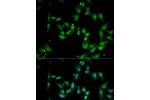 Immunofluorescence analysis of MCF7 cells using IL17F Polyclonal Antibody (IL17F Antikörper)