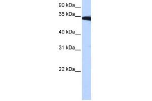 PIGW antibody used at 0. (PIGW Antikörper  (Middle Region))