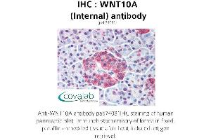 Image no. 1 for anti-Wingless-Type MMTV Integration Site Family, Member 10A (WNT10A) (Internal Region) antibody (ABIN1740816) (WNT10A Antikörper  (Internal Region))