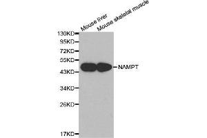 Western blot analysis of extracts of various cell lines, using NAMPT antibody. (NAMPT Antikörper  (AA 1-280))