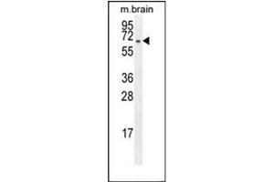 Western blot analysis of FBXO21 Antibody (C-term) Cat. (FBXO21 Antikörper  (C-Term))