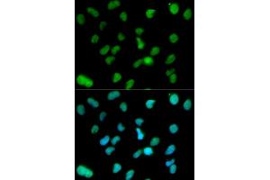 Immunofluorescence analysis of HeLa cell using KDM1A antibody. (LSD1 Antikörper  (AA 130-380))