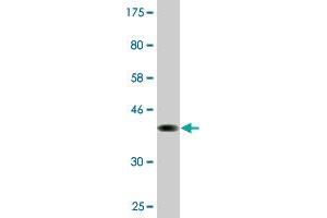 Western Blot detection against Immunogen (37. (PCDHGA2 Antikörper  (AA 223-331))