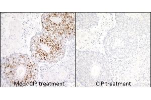 Immunohistochemistry (IHC) image for anti-Minichromosome Maintenance Complex Component 2 (MCM2) (pSer53) antibody (ABIN7449430) (Rekombinanter MCM2 Antikörper  (pSer53))
