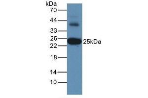 Detection of GSTa3 in Human Liver Tissue using Monoclonal Antibody to Glutathione S Transferase Alpha 3 (GSTa3) (GSTA3 Antikörper  (AA 1-222))