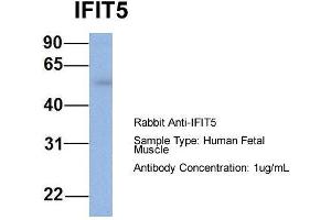 Host: Rabbit  Target Name: IFIT5  Sample Tissue: Human Fetal Muscle  Antibody Dilution: 1.