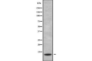 Western blot analysis S100G using HeLa whole cell lysates (S100G Antikörper  (Internal Region))