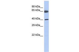 Image no. 1 for anti-Chimerin (Chimaerin) 2 (CHN2) (AA 71-120) antibody (ABIN6743598) (CHN2 Antikörper  (AA 71-120))