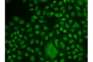 Immunofluorescence analysis of U2OS cells using TFPT antibody. (TFPT Antikörper)