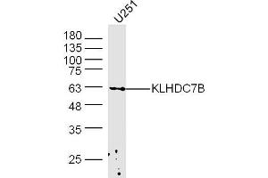 U251 lysates probed with KLHDC7B Polyclonal Antibody, Unconjugated  at 1:300 dilution and 4˚C overnight incubation. (KLHDC7B Antikörper  (AA 431-530))