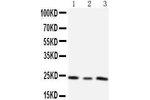 Anti-TIMP4 antibody,  Western blotting Lane 1:  Cell Lysate Lane 2: HELA Cell Lysate Lane 3: SMMC Cell Lysate