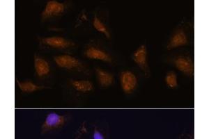 Immunofluorescence analysis of U-2 OS cells using P90RSK Polyclonal Antibody at dilution of 1:100. (RPS6KA3 Antikörper)