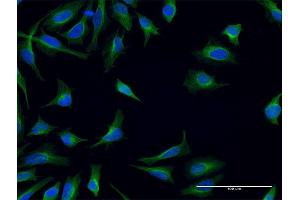 Immunofluorescence of monoclonal antibody to FPR2 on HeLa cell. (FPR2 Antikörper  (AA 163-205))
