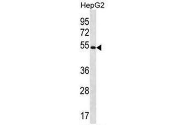 MGAT4C Antikörper  (C-Term)