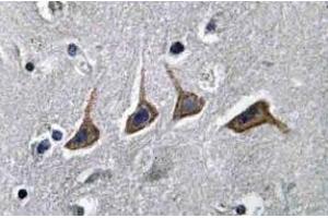 Immunohistochemistry analyzes of SLC22A6 / OAT1 Antibody in paraffin-embedded human brain tissue. (SLC22A6 Antikörper)