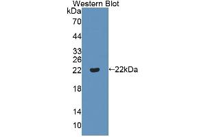 Western blot analysis of the recombinant protein. (ADAMTS13 Antikörper  (AA 682-859))