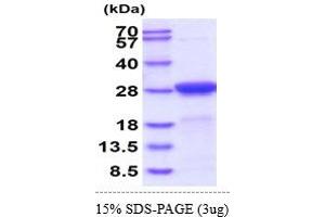 SDS-PAGE (SDS) image for Adenylate Kinase 1 (AK1) (AA 1-210) (Active) protein (His tag) (ABIN7529381)